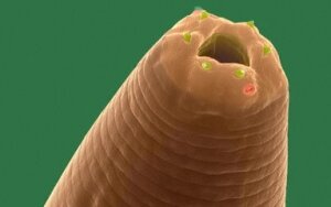 Caenorhabditis elegans